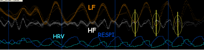 BIOFEEDBACK