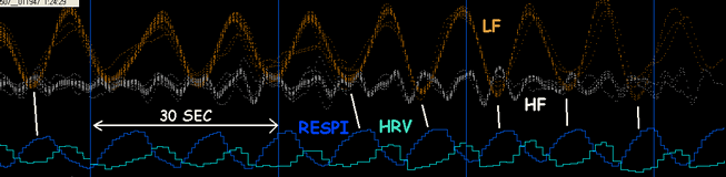 CRI LF HF HRV