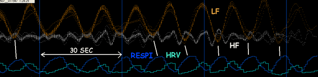 CRI LF HF