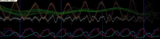 HRV LF HF VLF PULSATIONS