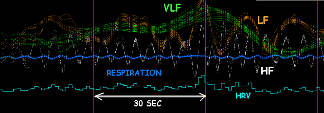 HRV LF VLF HF CARDIO RESPI