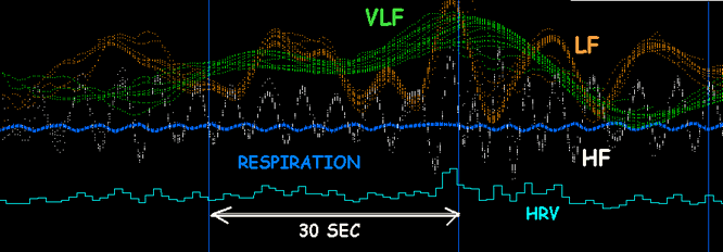 HRV LF VLF HF